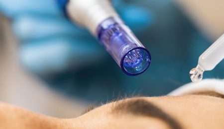 australian-beauty-association-microneedling